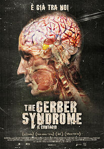 Watch The Gerber Syndrome: il contagio