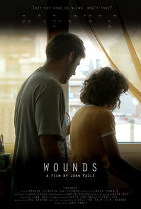 Watch Wounds