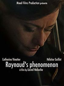 Watch Reynaud's Phenomenon