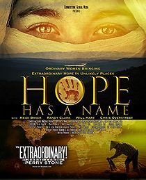 Watch Hope Has a Name