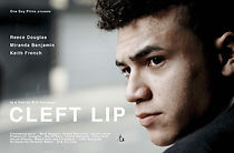 Watch Cleft Lip