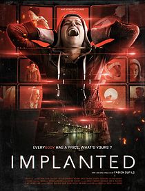 Watch Implanted