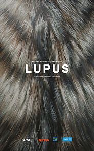 Watch LUPUS