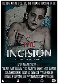Watch The Incision