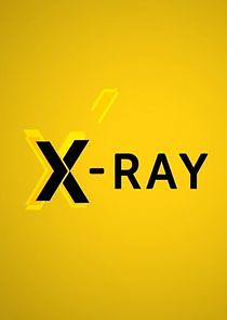 Watch X-Ray