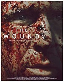 Watch The Wound