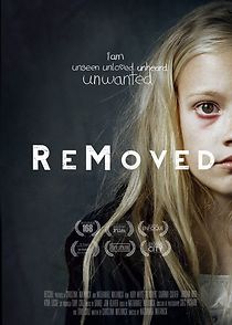 Watch ReMoved