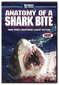 Watch Anatomy of a Shark Bite
